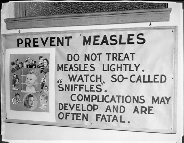 measles