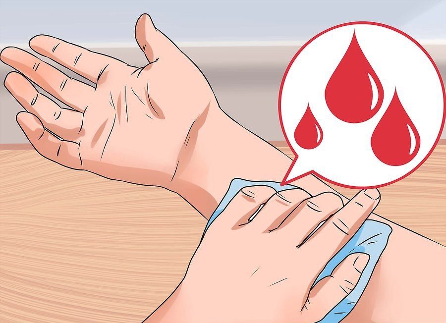 Bleeding Arm